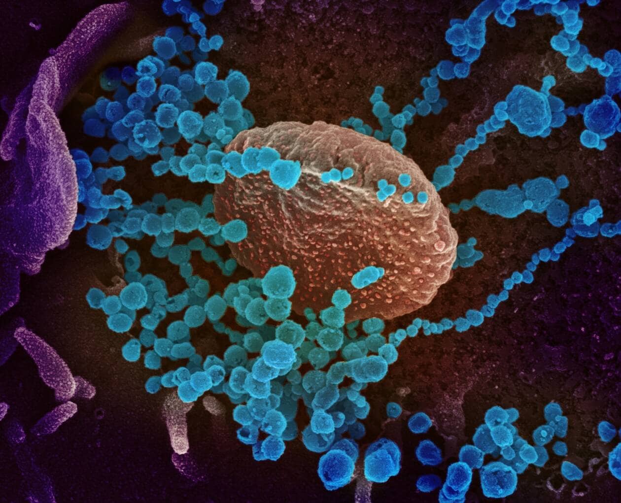 coronavirus en bleu, cellule en culture  orange